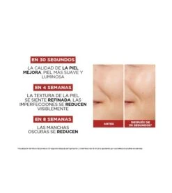 Loreal Paris - Revitalift Acide Glycolique Pur 5% Tonique Effet Peeling -Beauté Produits Magasin loreal paris tonico efecto peeling 5 acido glicolico puro revitalift 3 67330